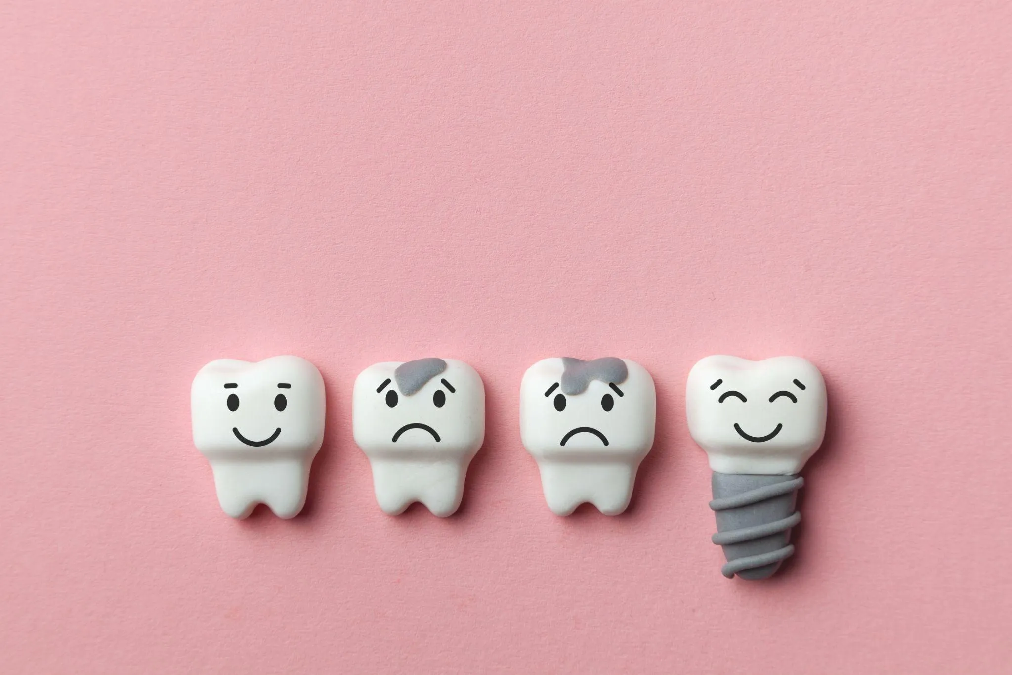 インプラントの平均寿命や寿命判断