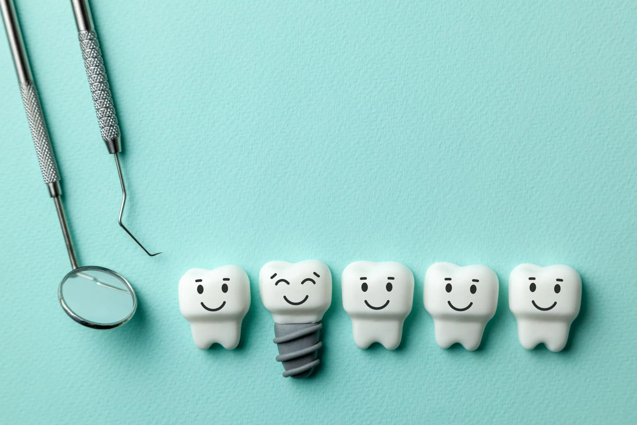 インプラントとは？