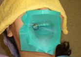 神戸市東灘区甲南山手にある歯科・歯医者の福山デンタルクリニックの無菌治療器具ラバーダムの写真